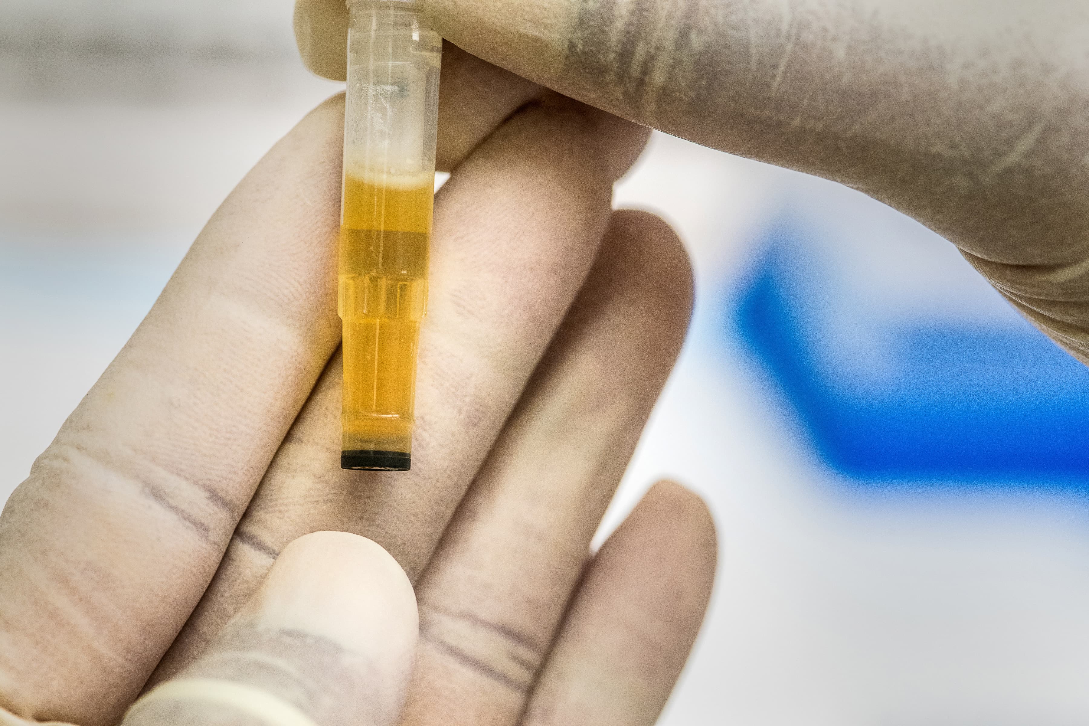 Urine Collection Only