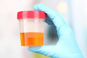 Urine Collection Only